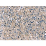 Immunohistochemistry - STK33 Antibody from Signalway Antibody (42768) - Antibodies.com