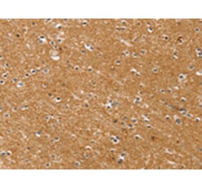 Immunohistochemistry - SYTL5 Antibody from Signalway Antibody (42770) - Antibodies.com