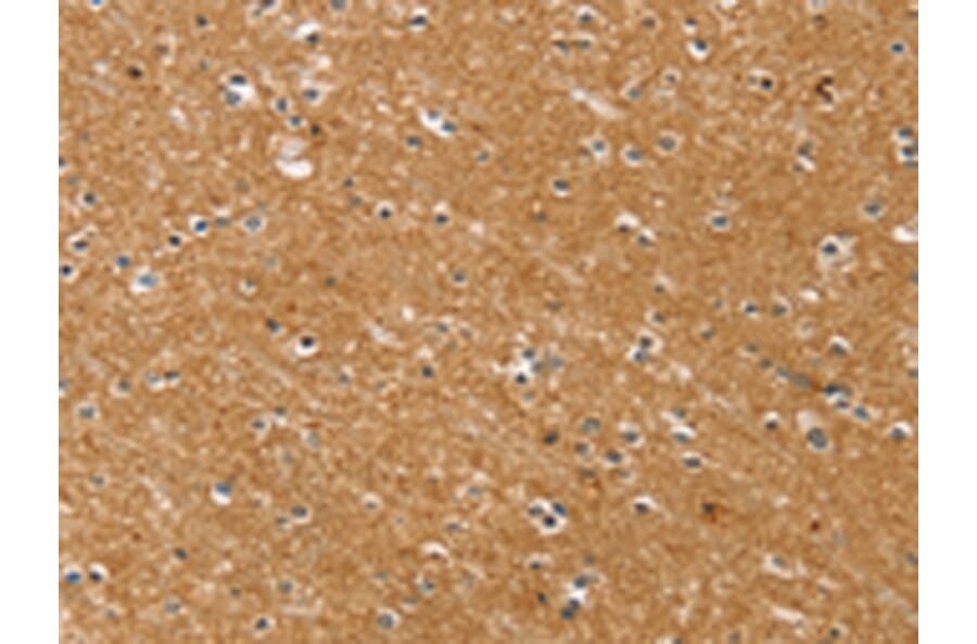Immunohistochemistry - SYTL5 Antibody from Signalway Antibody (42770) - Antibodies.com