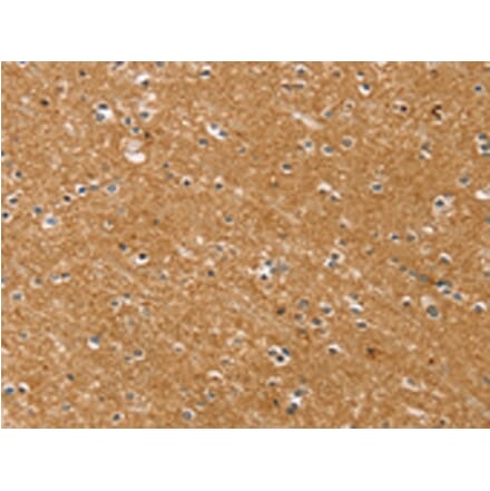 Immunohistochemistry - SYTL5 Antibody from Signalway Antibody (42770) - Antibodies.com