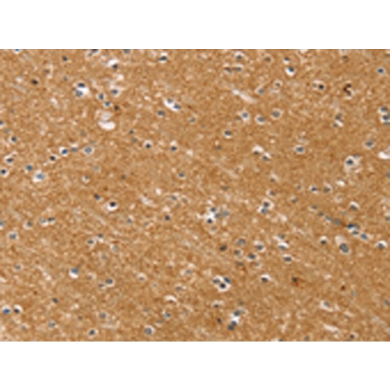 Immunohistochemistry - SYTL5 Antibody from Signalway Antibody (42770) - Antibodies.com