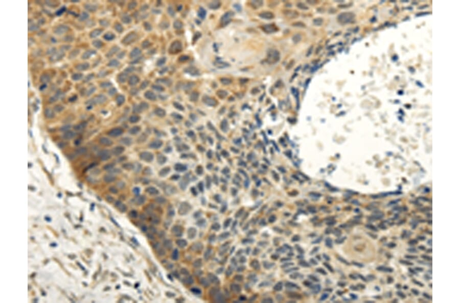 Immunohistochemistry - ABCB7 Antibody from Signalway Antibody (42773) - Antibodies.com