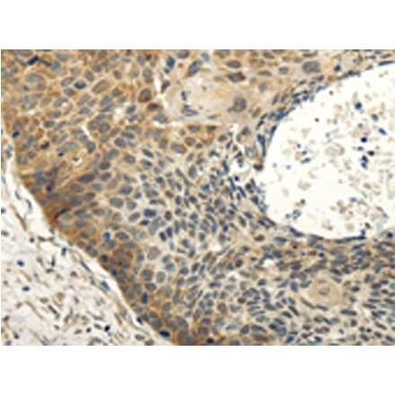 Immunohistochemistry - ABCB7 Antibody from Signalway Antibody (42773) - Antibodies.com