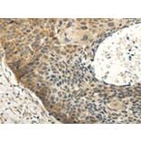 Immunohistochemistry - ABCB7 Antibody from Signalway Antibody (42773) - Antibodies.com