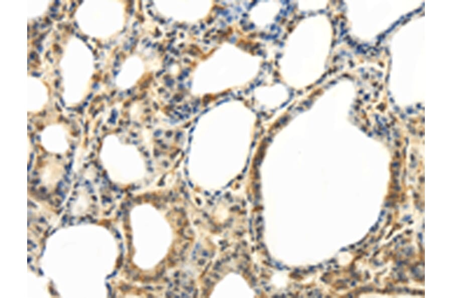 Immunohistochemistry - ABCB7 Antibody from Signalway Antibody (42773) - Antibodies.com