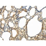 Immunohistochemistry - ABCB7 Antibody from Signalway Antibody (42773) - Antibodies.com