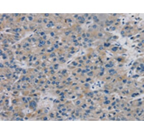 Immunohistochemistry - TBX18 Antibody from Signalway Antibody (42775) - Antibodies.com