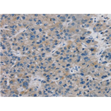 Immunohistochemistry - TBX18 Antibody from Signalway Antibody (42775) - Antibodies.com