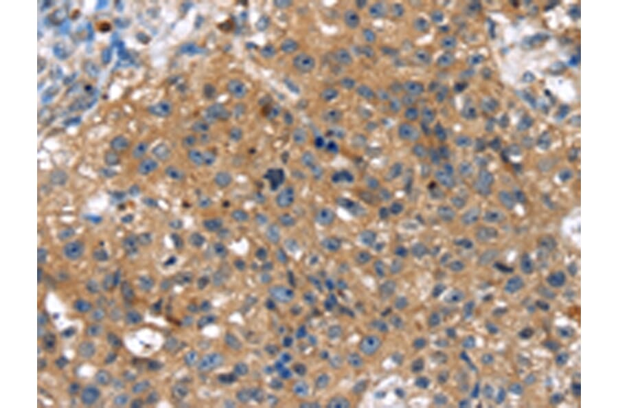 Immunohistochemistry - TBX10 Antibody from Signalway Antibody (42776) - Antibodies.com