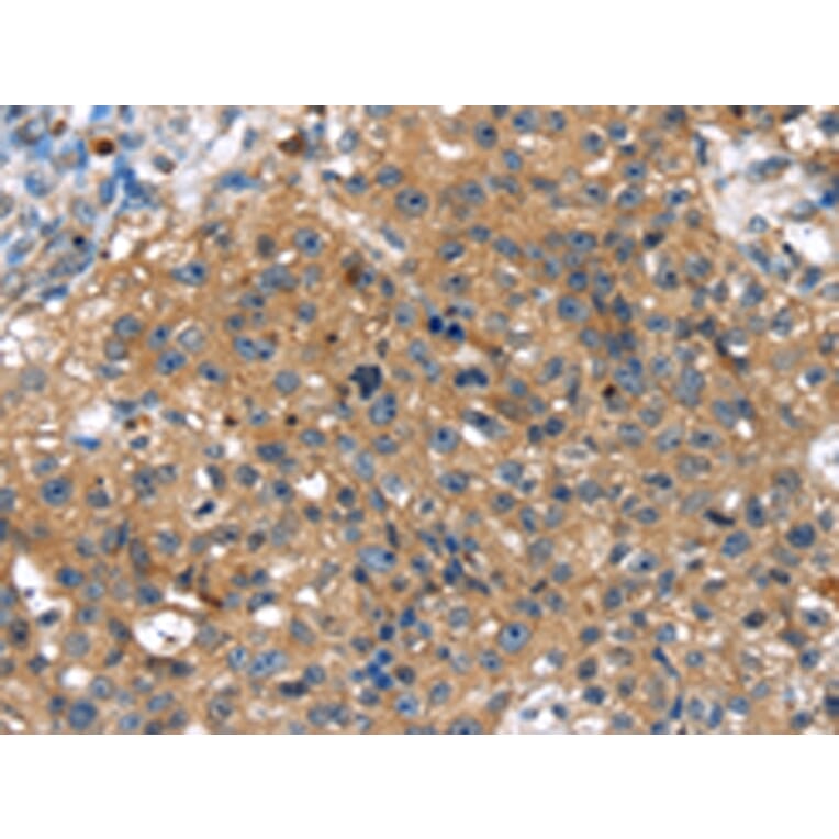 Immunohistochemistry - TBX10 Antibody from Signalway Antibody (42776) - Antibodies.com