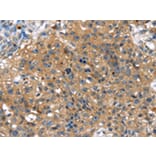 Immunohistochemistry - TBX10 Antibody from Signalway Antibody (42776) - Antibodies.com