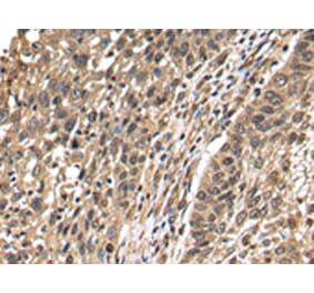 Immunohistochemistry - TFDP2 Antibody from Signalway Antibody (42777) - Antibodies.com