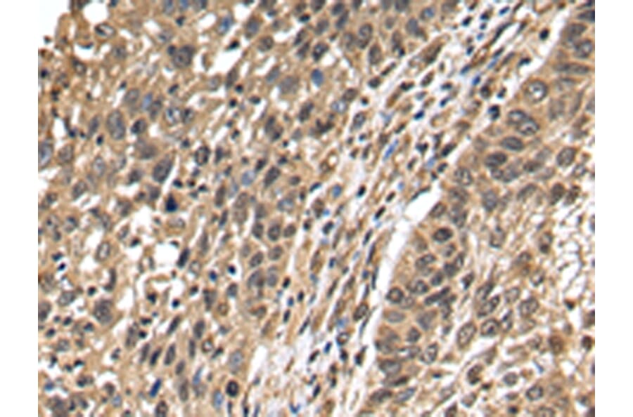 Immunohistochemistry - TFDP2 Antibody from Signalway Antibody (42777) - Antibodies.com