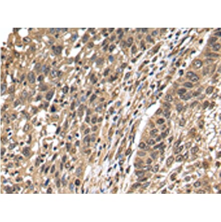 Immunohistochemistry - TFDP2 Antibody from Signalway Antibody (42777) - Antibodies.com