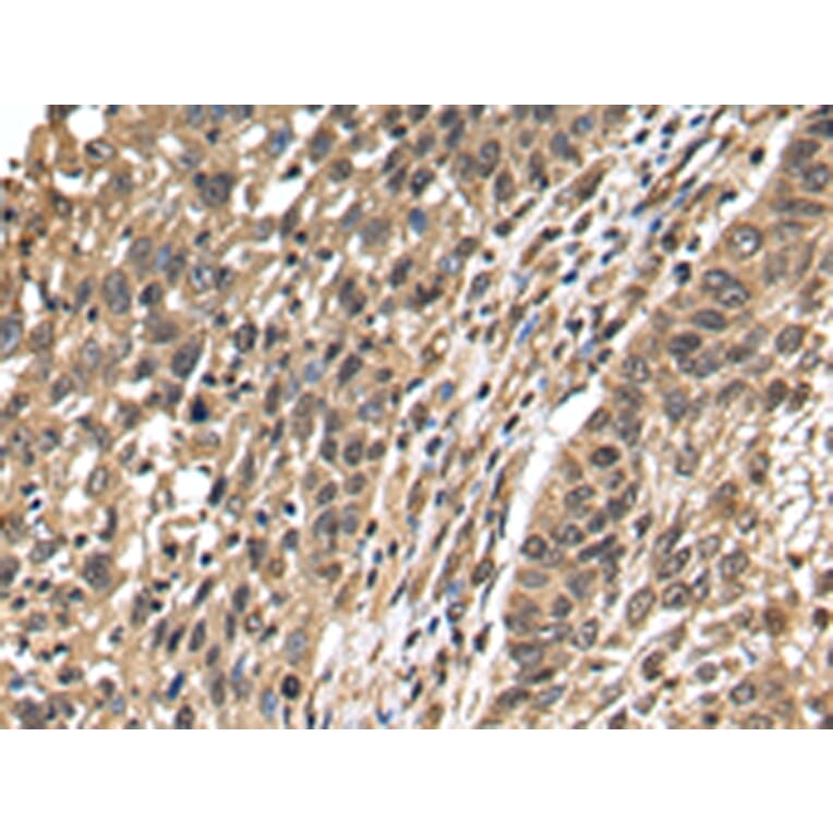 Immunohistochemistry - TFDP2 Antibody from Signalway Antibody (42777) - Antibodies.com