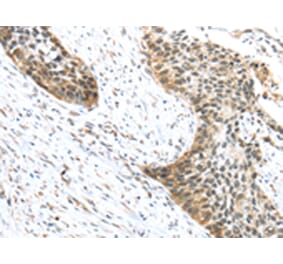 Immunohistochemistry - TRIP6 Antibody from Signalway Antibody (42789) - Antibodies.com