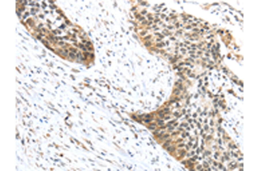 Immunohistochemistry - TRIP6 Antibody from Signalway Antibody (42789) - Antibodies.com