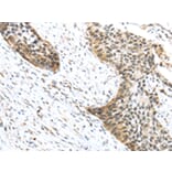 Immunohistochemistry - TRIP6 Antibody from Signalway Antibody (42789) - Antibodies.com