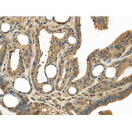Immunohistochemistry - KEAP1 Antibody from Signalway Antibody (42790) - Antibodies.com