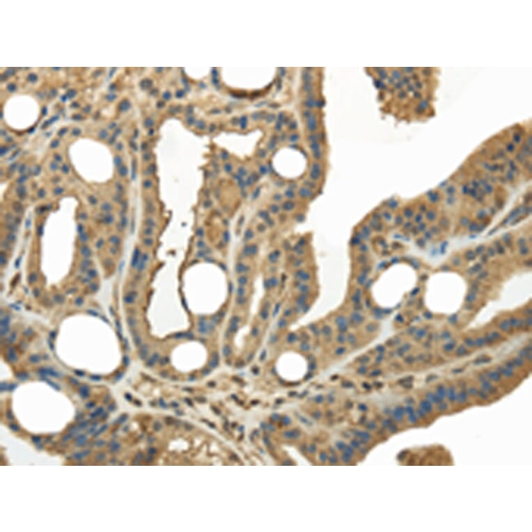 Immunohistochemistry - KEAP1 Antibody from Signalway Antibody (42790) - Antibodies.com