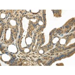 Immunohistochemistry - KEAP1 Antibody from Signalway Antibody (42790) - Antibodies.com