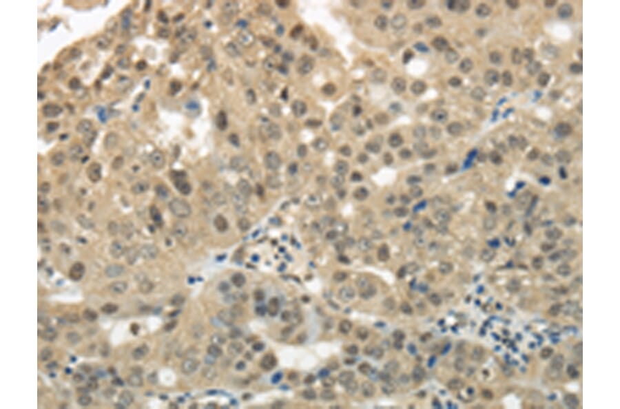 Immunohistochemistry - KEAP1 Antibody from Signalway Antibody (42790) - Antibodies.com