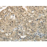 Immunohistochemistry - KEAP1 Antibody from Signalway Antibody (42790) - Antibodies.com