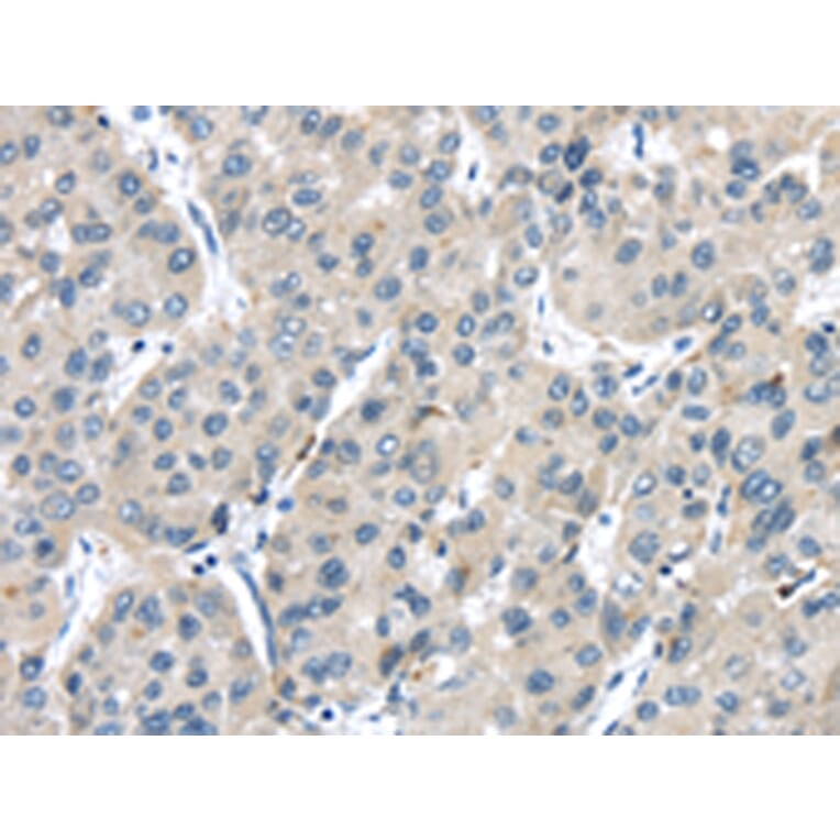 Immunohistochemistry - TRPM2 Antibody from Signalway Antibody (42793) - Antibodies.com