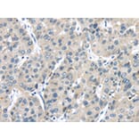 Immunohistochemistry - TRPM2 Antibody from Signalway Antibody (42793) - Antibodies.com