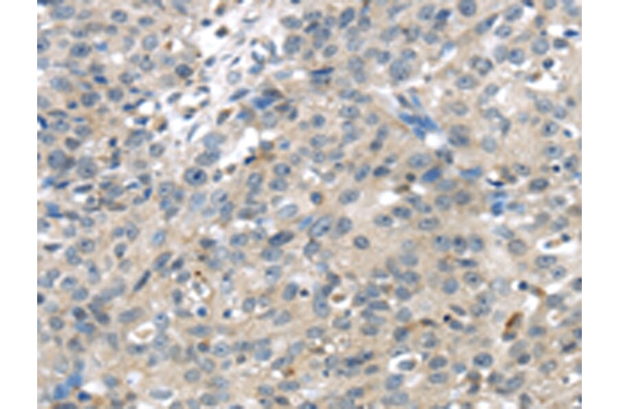 Immunohistochemistry - TRPM2 Antibody from Signalway Antibody (42793) - Antibodies.com