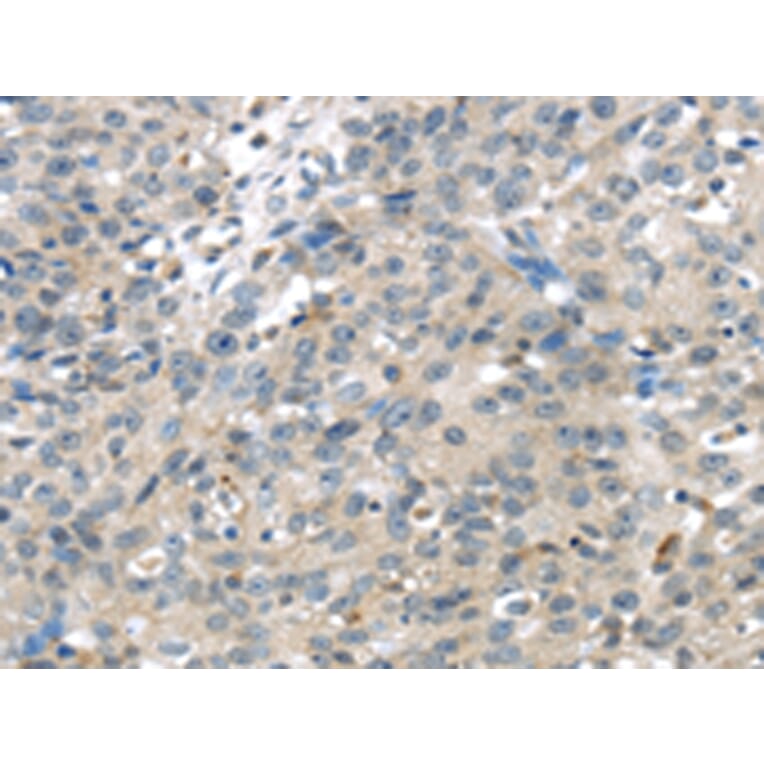 Immunohistochemistry - TRPM2 Antibody from Signalway Antibody (42793) - Antibodies.com