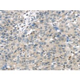 Immunohistochemistry - TRPM2 Antibody from Signalway Antibody (42793) - Antibodies.com