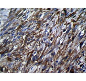 Immunohistochemistry - TSSC1 Antibody from Signalway Antibody (42794) - Antibodies.com