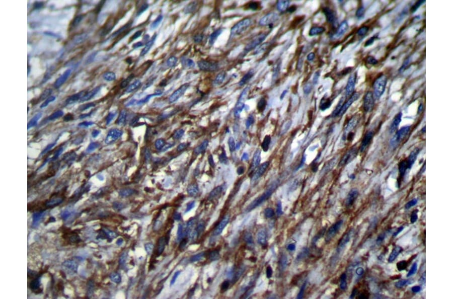 Immunohistochemistry - TSSC1 Antibody from Signalway Antibody (42794) - Antibodies.com
