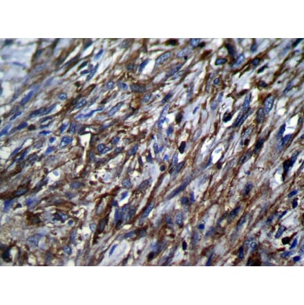 Immunohistochemistry - TSSC1 Antibody from Signalway Antibody (42794) - Antibodies.com