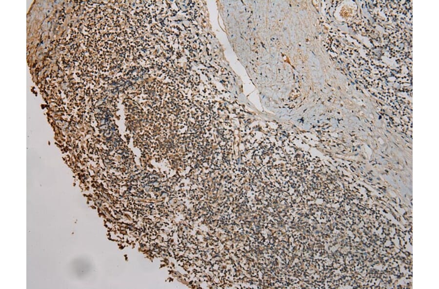 Immunohistochemistry - UBE2B Antibody from Signalway Antibody (42801) - Antibodies.com