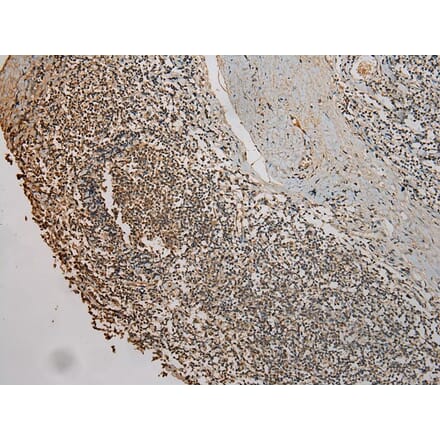 Immunohistochemistry - UBE2B Antibody from Signalway Antibody (42801) - Antibodies.com