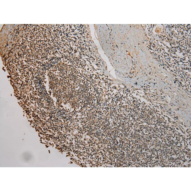 Immunohistochemistry - UBE2B Antibody from Signalway Antibody (42801) - Antibodies.com