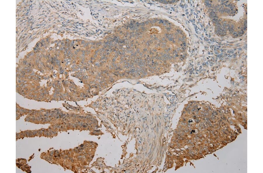 Immunohistochemistry - UBE2B Antibody from Signalway Antibody (42801) - Antibodies.com