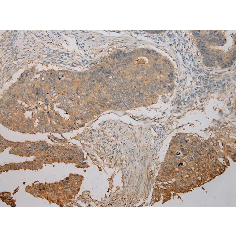 Immunohistochemistry - UBE2B Antibody from Signalway Antibody (42801) - Antibodies.com