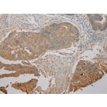 Immunohistochemistry - UBE2B Antibody from Signalway Antibody (42801) - Antibodies.com