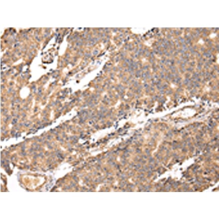 Immunohistochemistry - UGGT2 Antibody from Signalway Antibody (42803) - Antibodies.com