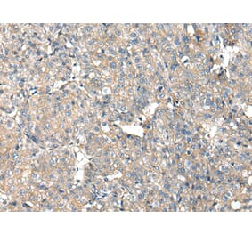 Immunohistochemistry - ITGA5 Antibody from Signalway Antibody (42807) - Antibodies.com