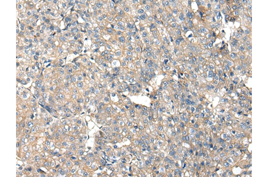 Immunohistochemistry - ITGA5 Antibody from Signalway Antibody (42807) - Antibodies.com