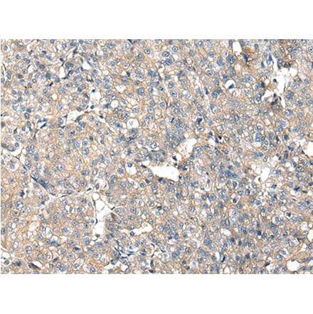 Immunohistochemistry - ITGA5 Antibody from Signalway Antibody (42807) - Antibodies.com