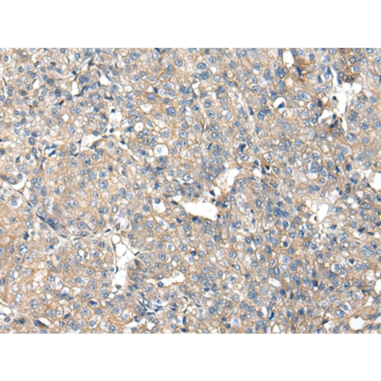 Immunohistochemistry - ITGA5 Antibody from Signalway Antibody (42807) - Antibodies.com