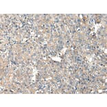 Immunohistochemistry - ITGA5 Antibody from Signalway Antibody (42807) - Antibodies.com