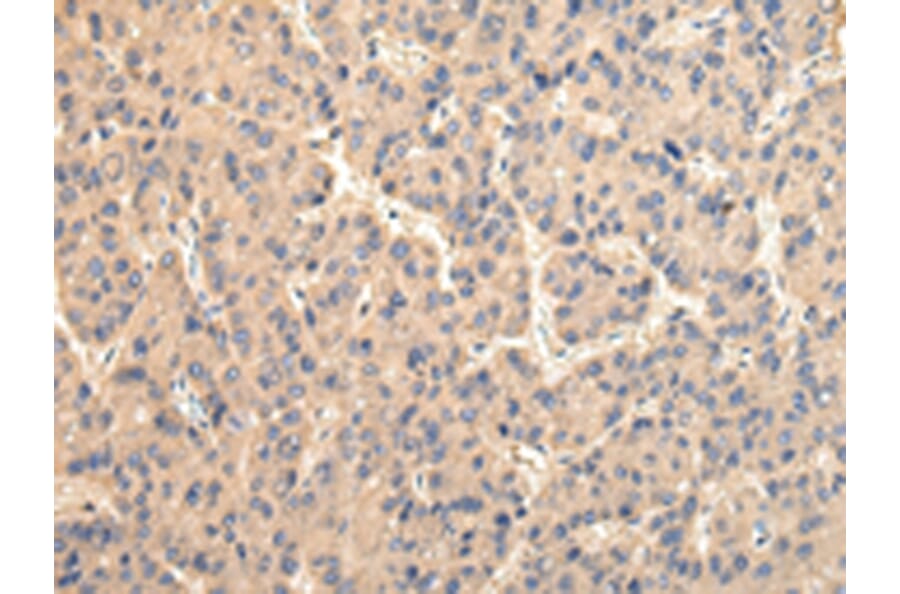 Immunohistochemistry - USP15 Antibody from Signalway Antibody (42821) - Antibodies.com