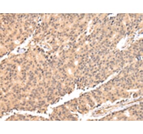 Immunohistochemistry - USP45 Antibody from Signalway Antibody (42822) - Antibodies.com