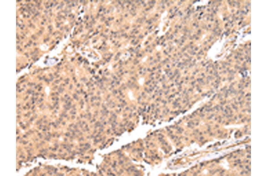 Immunohistochemistry - USP45 Antibody from Signalway Antibody (42822) - Antibodies.com